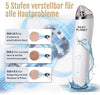 Mitesser Porenreiniger
